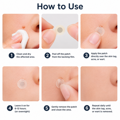 ✨Alcuras® 2-in-1 Microneedle & Hydrocolloid Patch🍀| Removes Raised Moles, Acne, Flat Warts & Skin Tags | Helps Improve Wrinkles, Scars & Blemishes | Invisible Patches for Face & Body