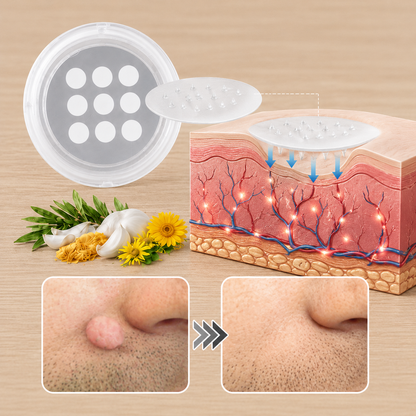 ✨Alcuras® 2-in-1 Microneedle & Hydrocolloid Patch🍀| Removes Raised Moles, Acne, Flat Warts & Skin Tags | Helps Improve Wrinkles, Scars & Blemishes | Invisible Patches for Face & Body