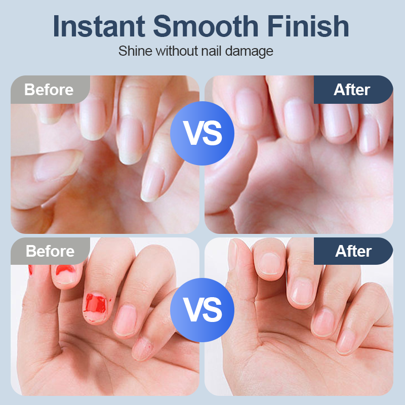 Smart Fingernail Grinder Pro – Automatic Nail Trimming for Adults & Kids 💅